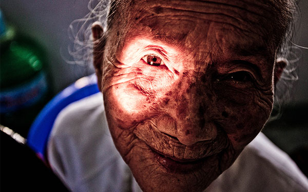 Pioneering Optometry in Vietnam