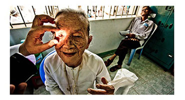 eye exam